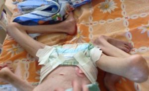 young child's contorted body